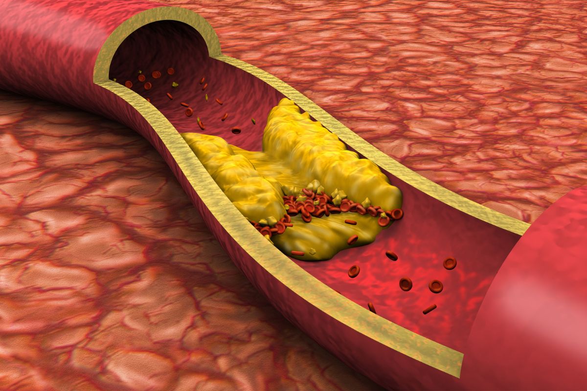 Cholesterol