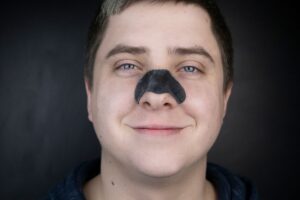 nasal strips for blackheads