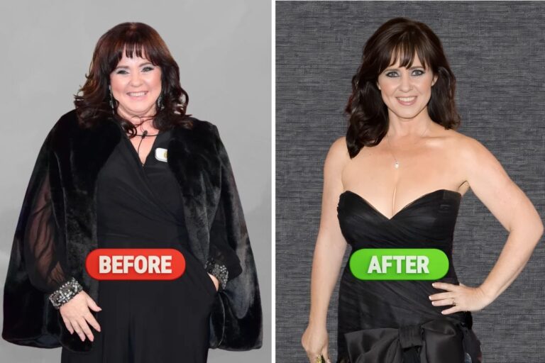The Honest Truth About the Coleen Nolan Weight Loss Journey
